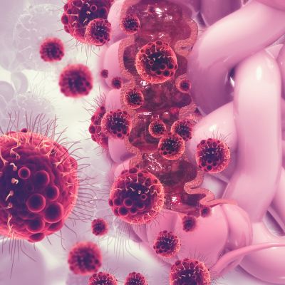 Colon cancer. Cancer attacking cell. Colon disease concept. 3d illustration
