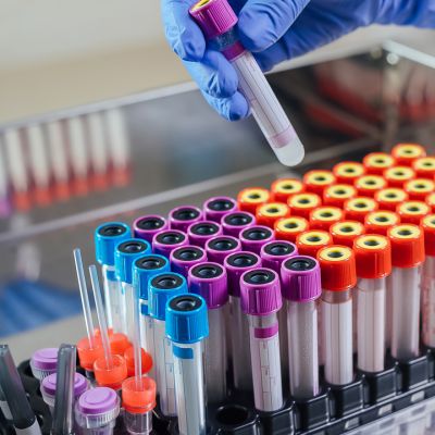 Blood Drawing equipment in laboratory for analysis