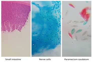 CRISPR-Cas-Related Breakthroughs in CRC Diagnostics – oncoscreen.health