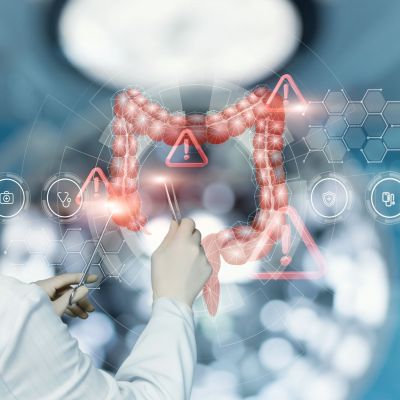 Doctor reveals errors in the treatment of the large intestine .