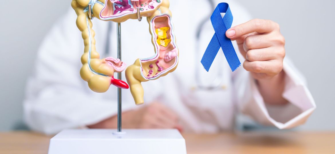 Doctor holding Blue ribbon with human Colon anatomy model. March Colorectal Cancer Awareness month, Colonic disease, Large Intestine, Ulcerative colitis, Digestive system and Health concept