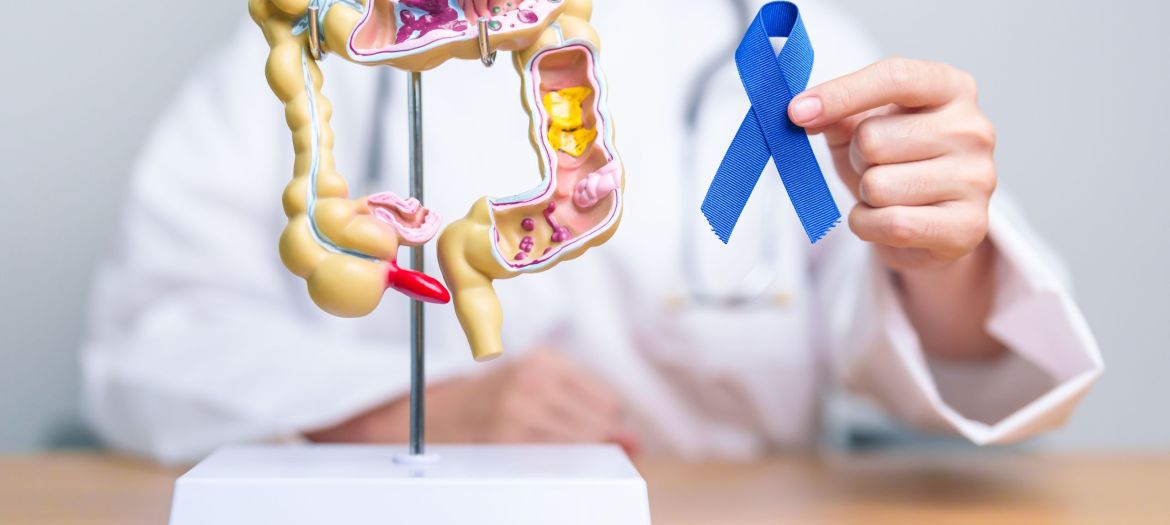 Doctor holding Blue ribbon with human Colon anatomy model. March Colorectal Cancer Awareness month, Colonic disease, Large Intestine, Ulcerative colitis, Digestive system and Health concept