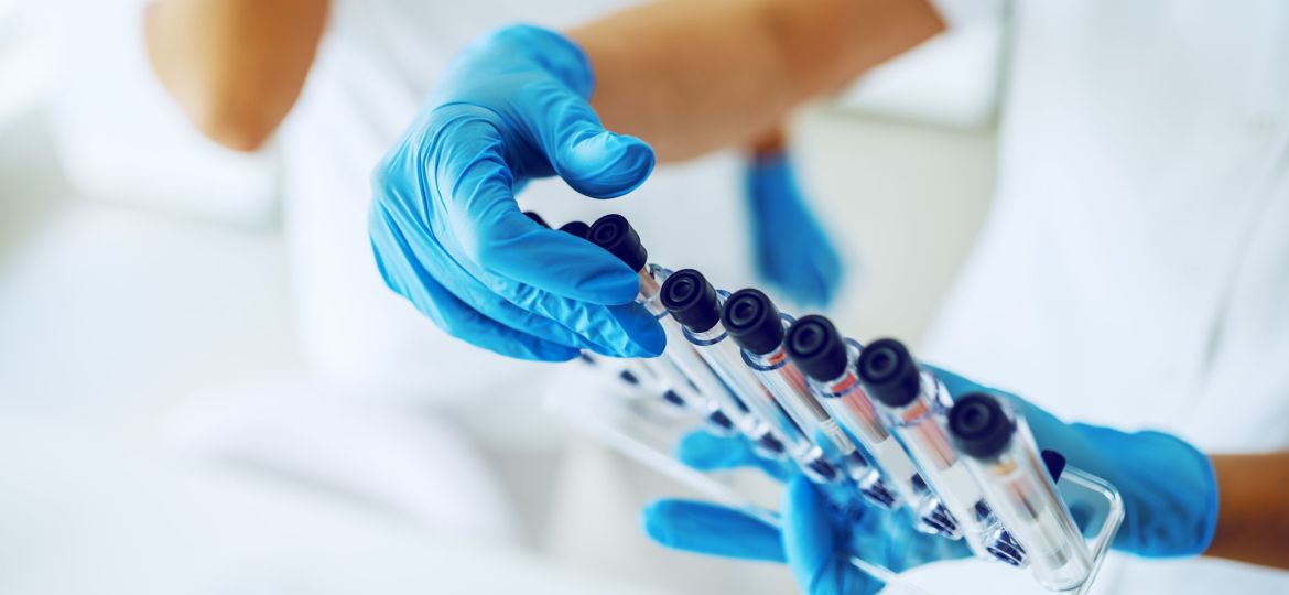 Close up of lab assistant with sterile rubber gloves holding stand with test tubes with blood samples.