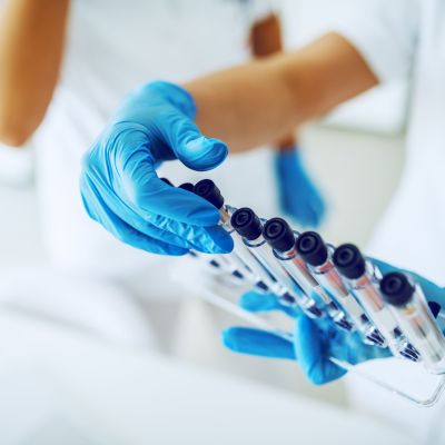 Close up of lab assistant with sterile rubber gloves holding stand with test tubes with blood samples.