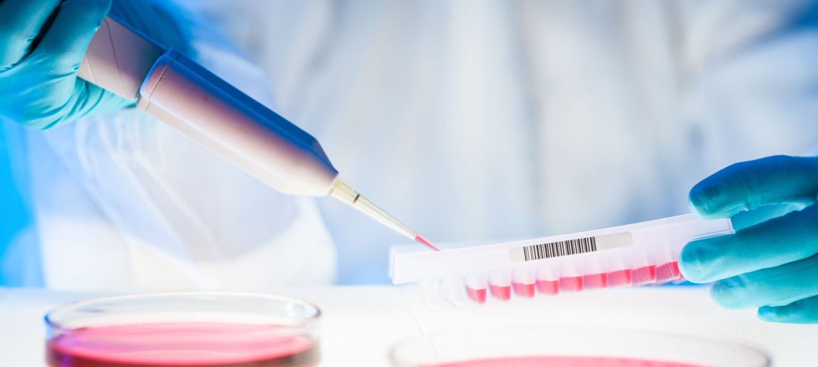 Life science professional pipetting human serum media containing HIV infected cells from petri dish to microtiter plate. High protection degree work.