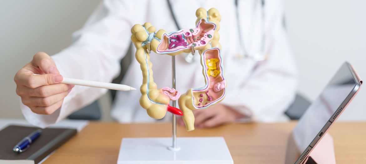 Doctor with human Colon anatomy model and tablet. Colonic disease, Large Intestine, Colorectal cancer, Ulcerative colitis, Diverticulitis, Irritable bowel syndrome and Digestive system