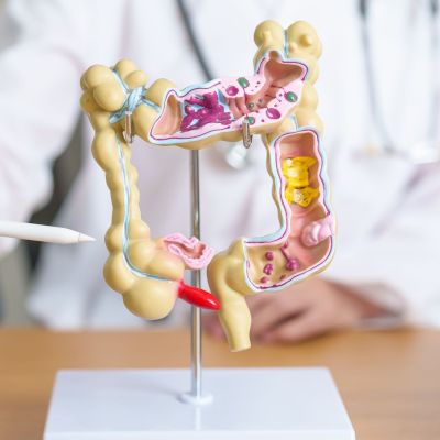 Doctor with human Colon anatomy model and tablet. Colonic disease, Large Intestine, Colorectal cancer, Ulcerative colitis, Diverticulitis, Irritable bowel syndrome and Digestive system